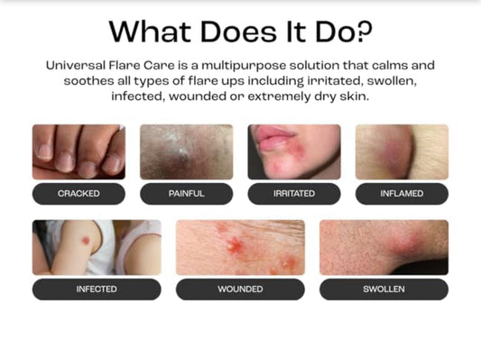 Discover Natural Remedies for Healing Hidradenitis Suppurativa Symptoms